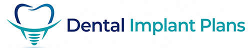 Dental Implant Plans